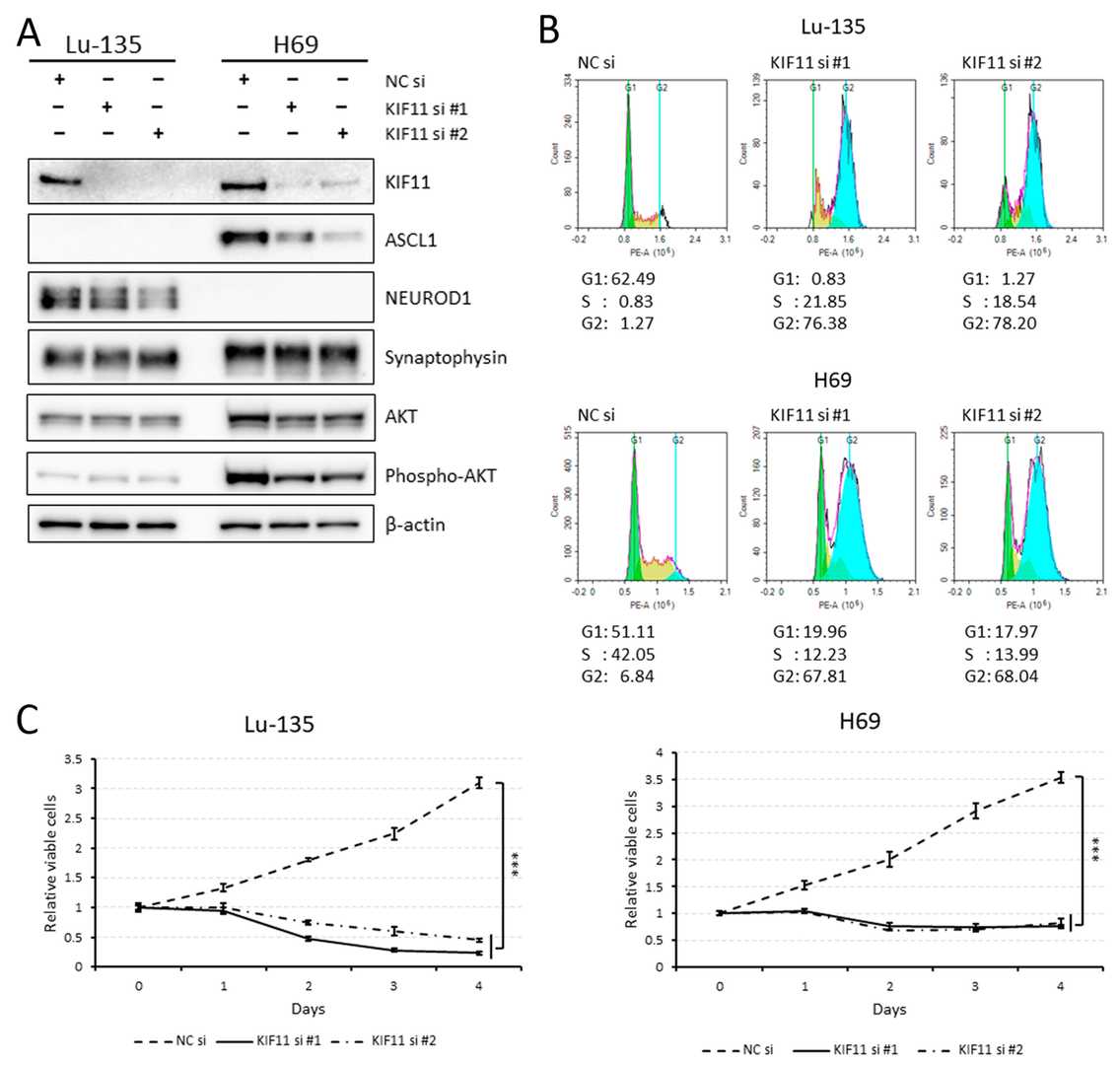 Silencing KIF11 using small interfering RNAs (siRNAs) induces cell cycle arrest at the G2/M phase in both Lu-135 and H69 cells.