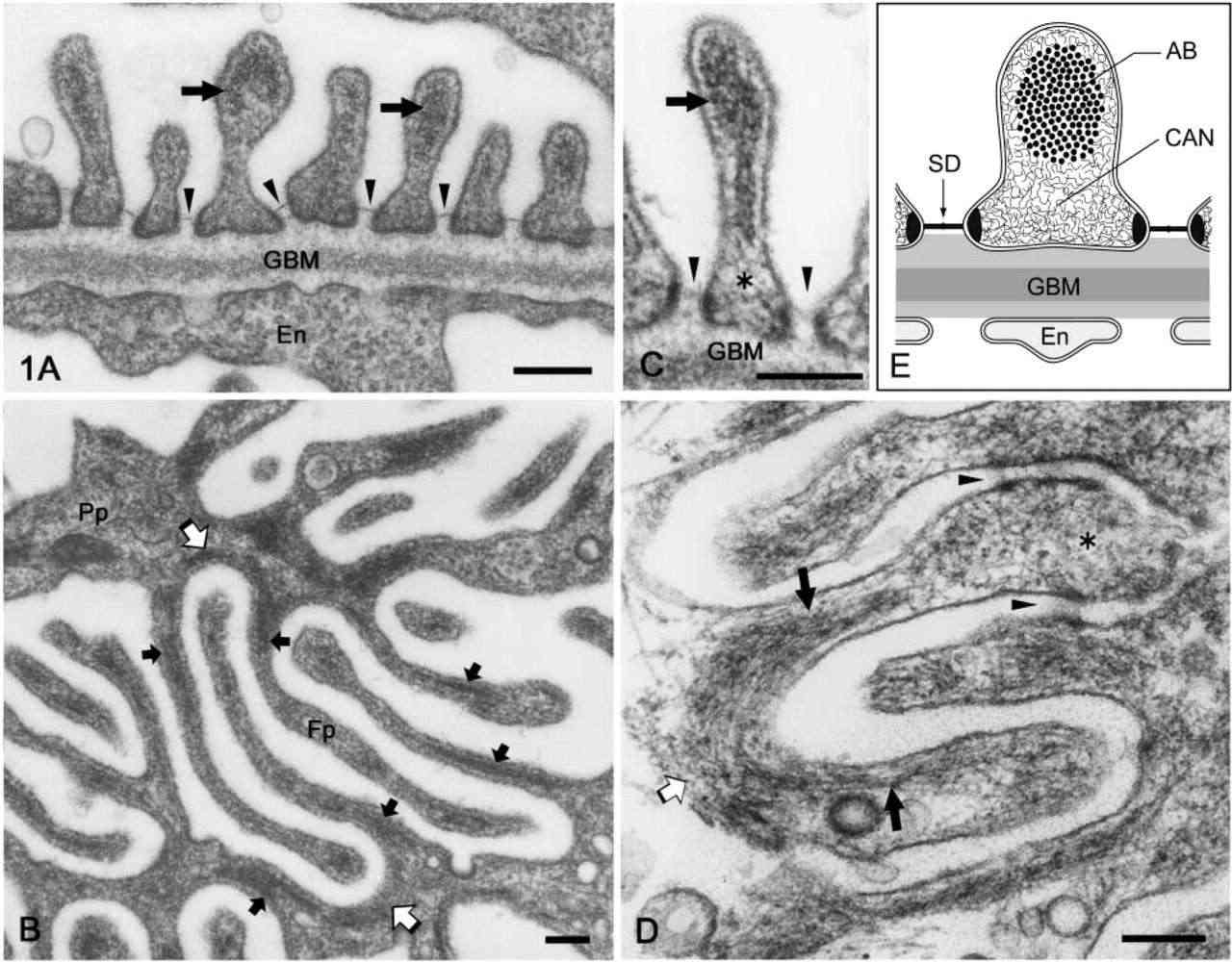 Electron microscopy images depicting the foot processes of rat podocytes.