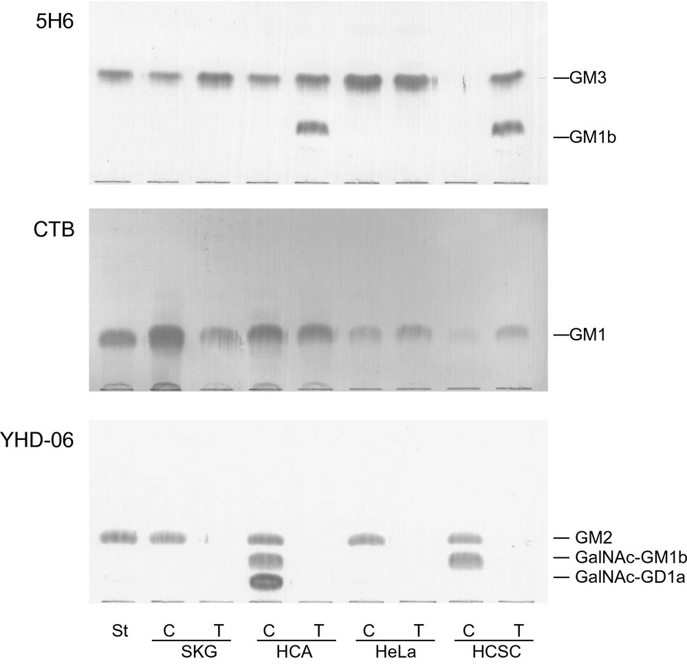 TLC-immunostaining was performed using anti-GM3 (5H6) antibodies, CTB, and anti-GM2 (YHD-06) antibodies on lipid extracts from both cultured (C) and transplanted (T) cells derived from cervical carcinoma.
