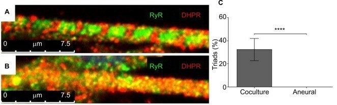 Myotubes' characterization at day 14.