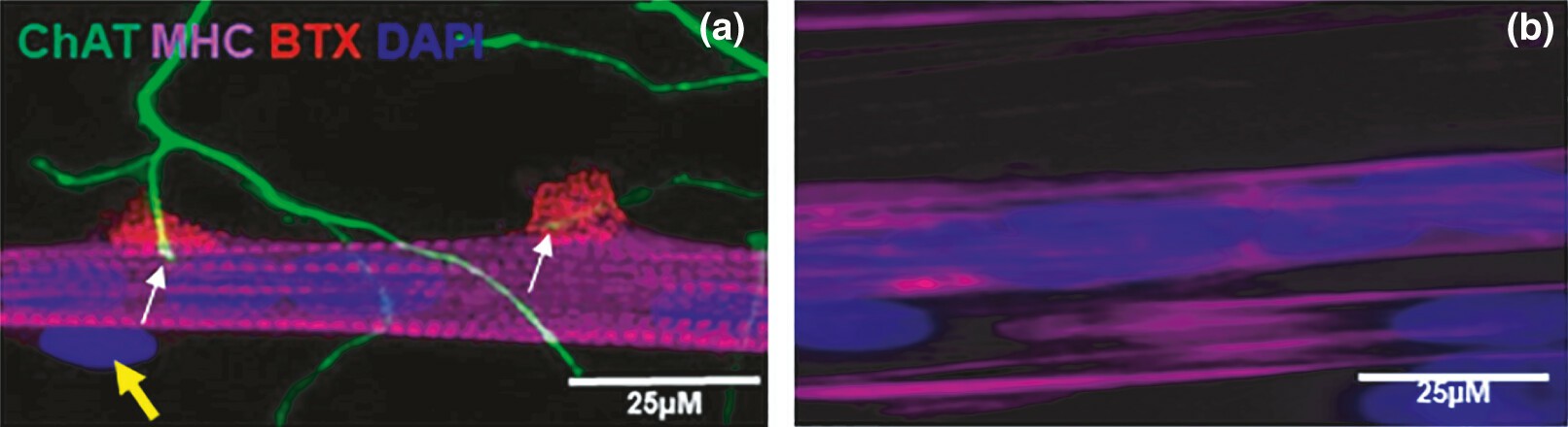 Neuromuscular junctions (NMJs) in co-cultures of immortalized human skeletal muscle cells with rat embryonic spinal cord explants (a) and in aneurally cultured immortalized human skeletal muscle cells (b) at day 7.