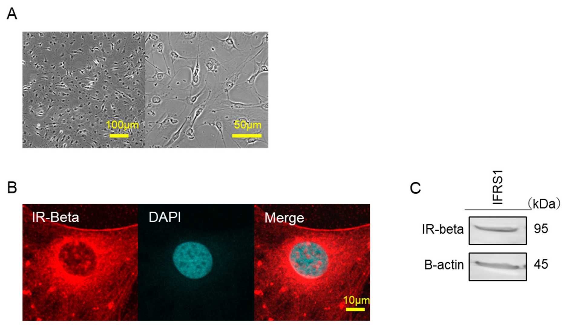 Insulin receptors were identified in these cells.