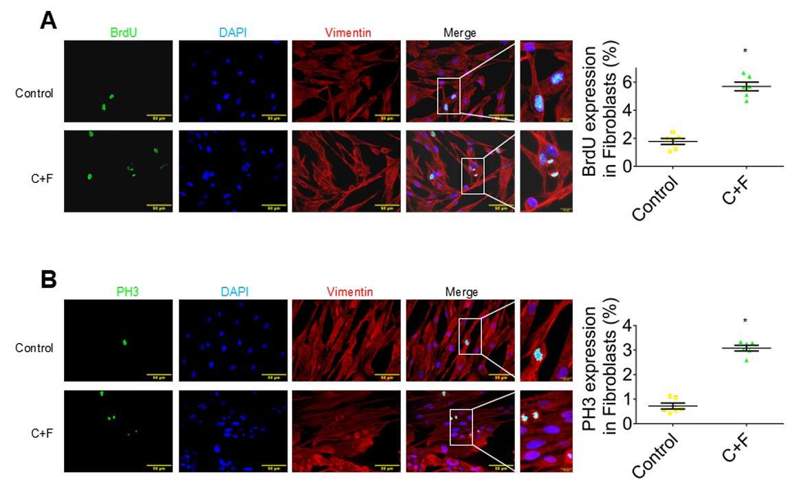 In vitro evaluation of the cell cycle in cardiac fibroblasts.