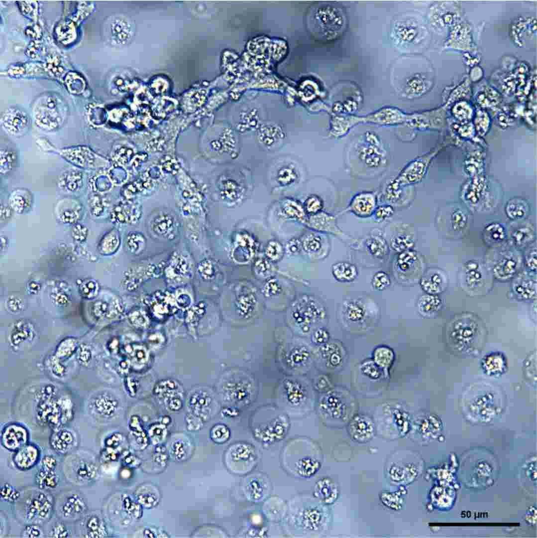 Cytopathic effects in SSN-1 cells inoculated with the filtrate from naturally infected Murray cod fry tissue samples.