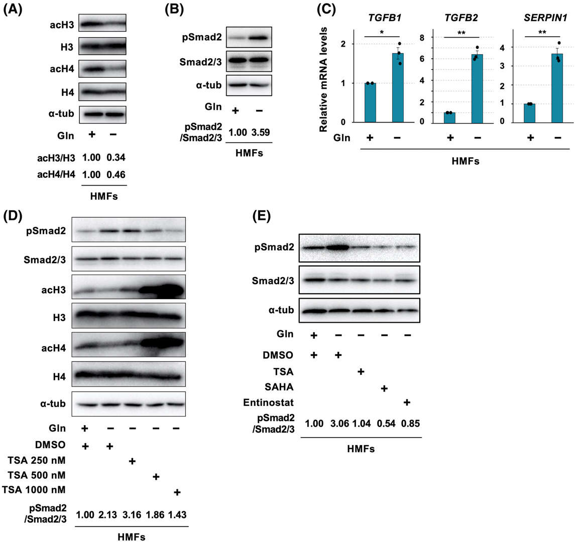 Gln starvation induces global histone deacetylation and TGF-β-Smad2/3 signaling activation in human mammary fibroblasts in a class I histone deacetylase-dependent fashion.