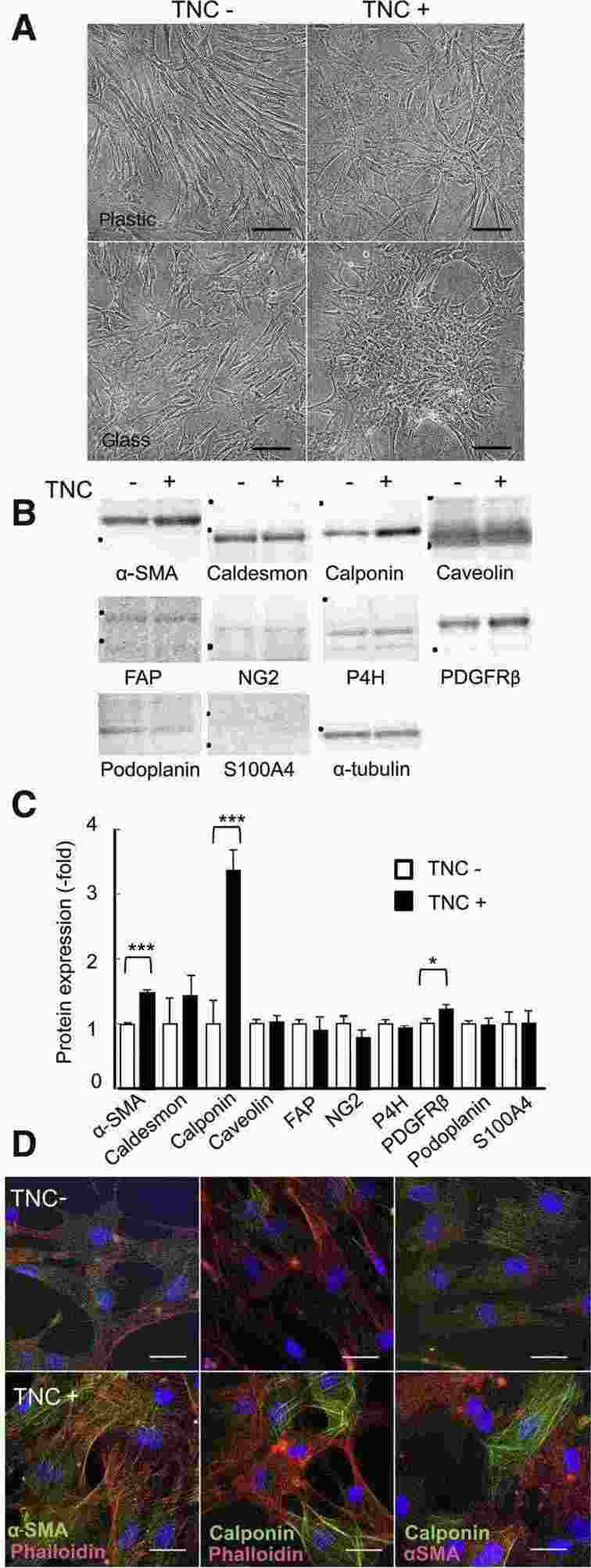 TNC treatment caused morphological alterations and changed expression of CAF markers in human mammary fibroblasts.