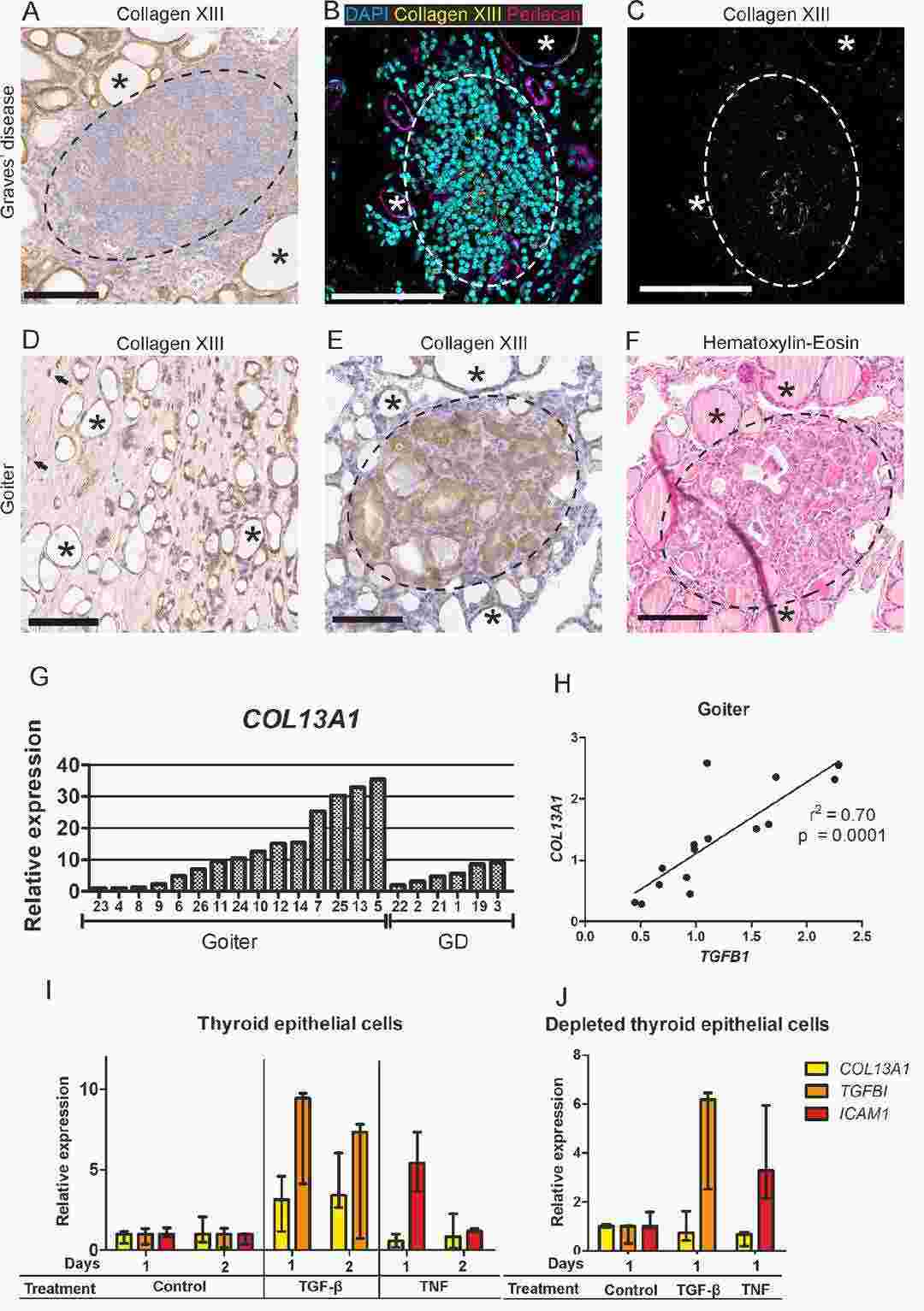 The presence of collagen XIII is observed in goiter and Graves' disease thyroids.