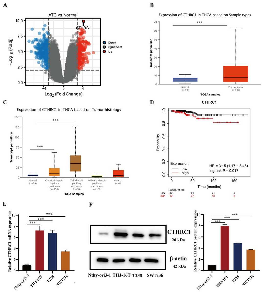 Upregulation of CTHRC1 was detected in ATC tissues and cell lines.
