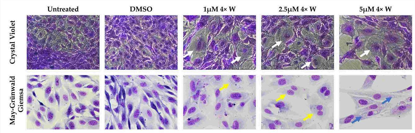 Morphological comparison of cells pre- and post-treatment.