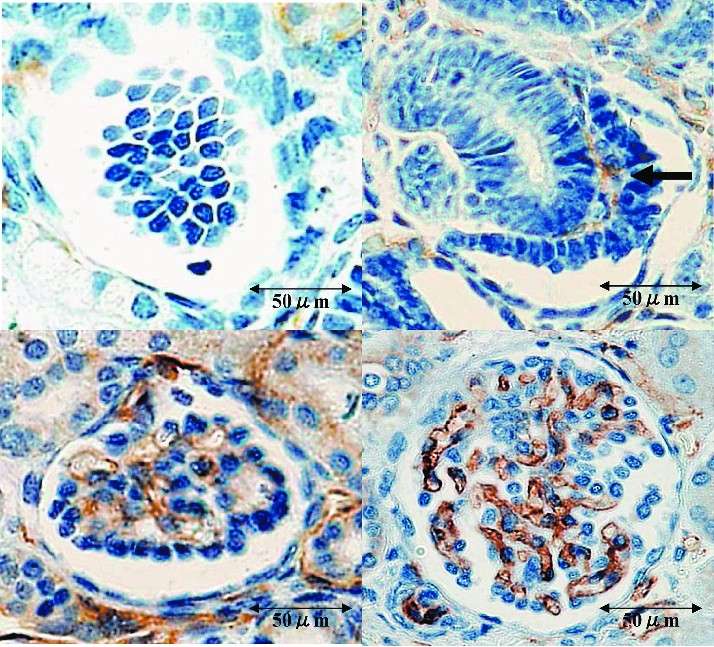 CD31 staining of glomerular endothelial cells.