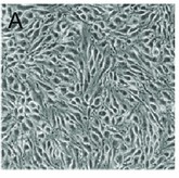 The morphology of bEnd.3 cells.