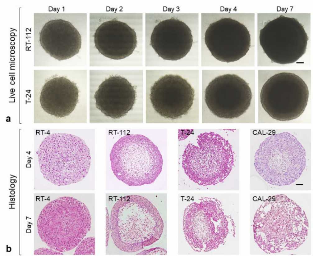 Live Cell Observation and Histology of Bladder Cancer (BCa) Organoids.