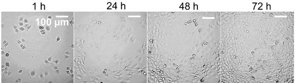 Cal33 cells' representative images.