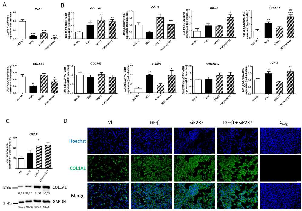 P2X7 influences collagen production in HSIFs.