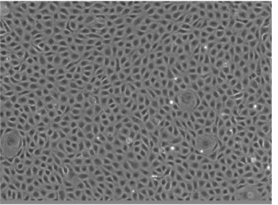 Human lung microvascular endothelial cells in culture.