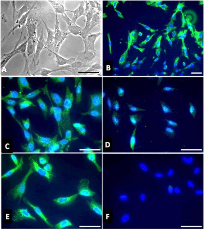 Characterization of primary cultured human Schwann cells.