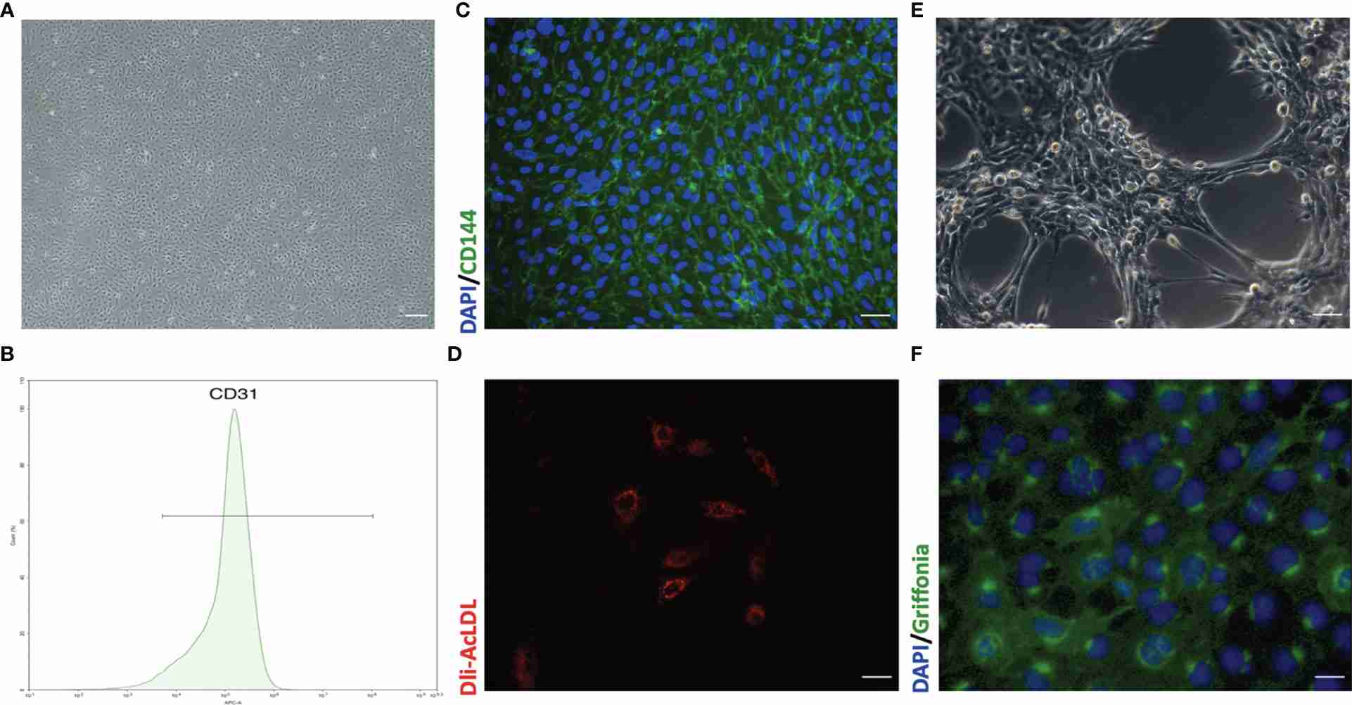 Representative morphology and identification of primary mouse pulmonary microvascular endothelial cells.