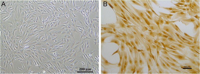 Cell morphology of NPCs (a); immunohistochemical of collagen II (b).