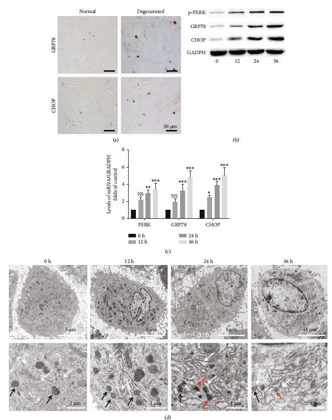 ERS plays a critical role in compression-induced programmed necrosis of nucleus pulposus cells.