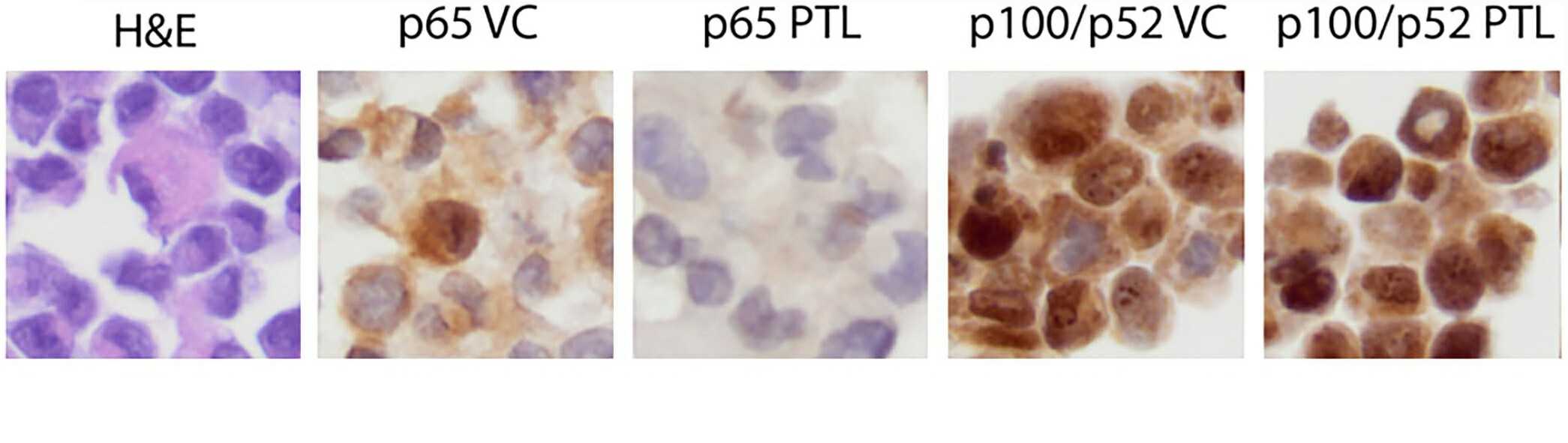 Hematoxylin and eosin staining (left panel) and p65 and p52 immunohistochemical analysis (other panels) of canine cell line pellets exposed to vehicle control (VC) or the NF-kB inhibitor parthenolide (PTL).