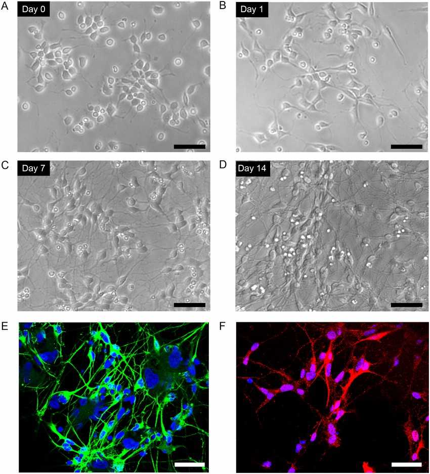 Culture of Human iPSC-Derived Dopaminergic Neurons.
