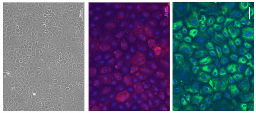 Morphology of fresh rabbit corneal epithelial cells s (left). Immunohistochemistry of the fibroblastic markers α-SMA (middle) and vimentin (right).