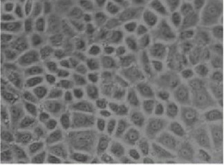 Rat pulmonary microvascular endothelial cells morphology.