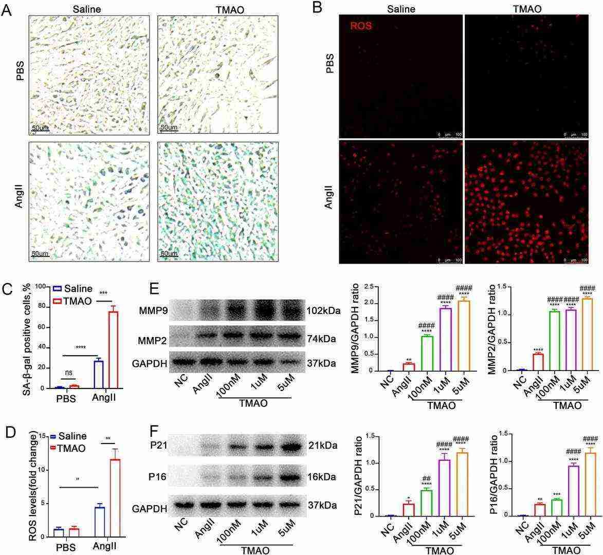 Trimethylamine N-oxide (TMAO) increases AngII-induced cellular senescence and ROS accumulation in vitro.