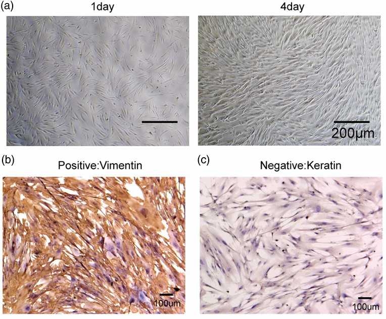 Identification of HGF-1. (A) Morphological observation of HGF-1 through a microscope (40×). (B and C) Detection of vimentin and cytokeratin in HGF-1 cells by IHC.