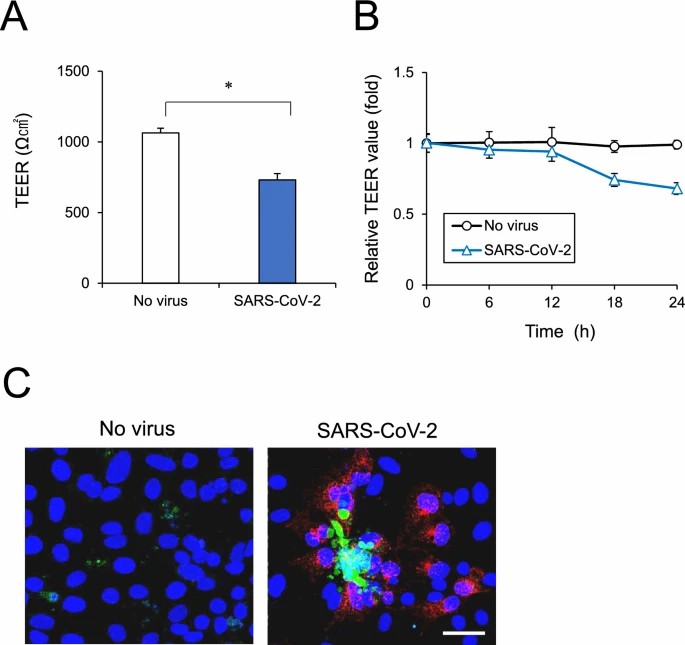 Brain microvascular endothelial cells monolayer barrier examined after SARS-CoV-2 infection.