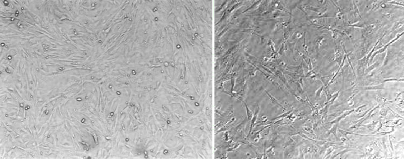 Mouse embryonic fibroblasts