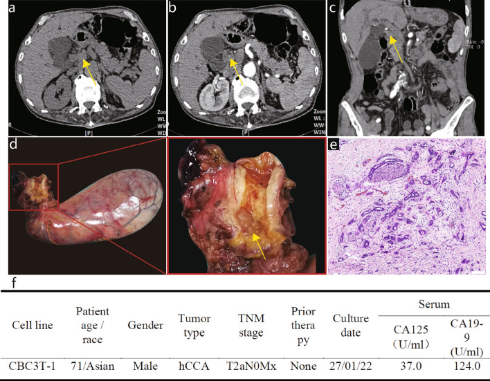 Fig. 1 Clinical and pathological profile of CBC3T-1.