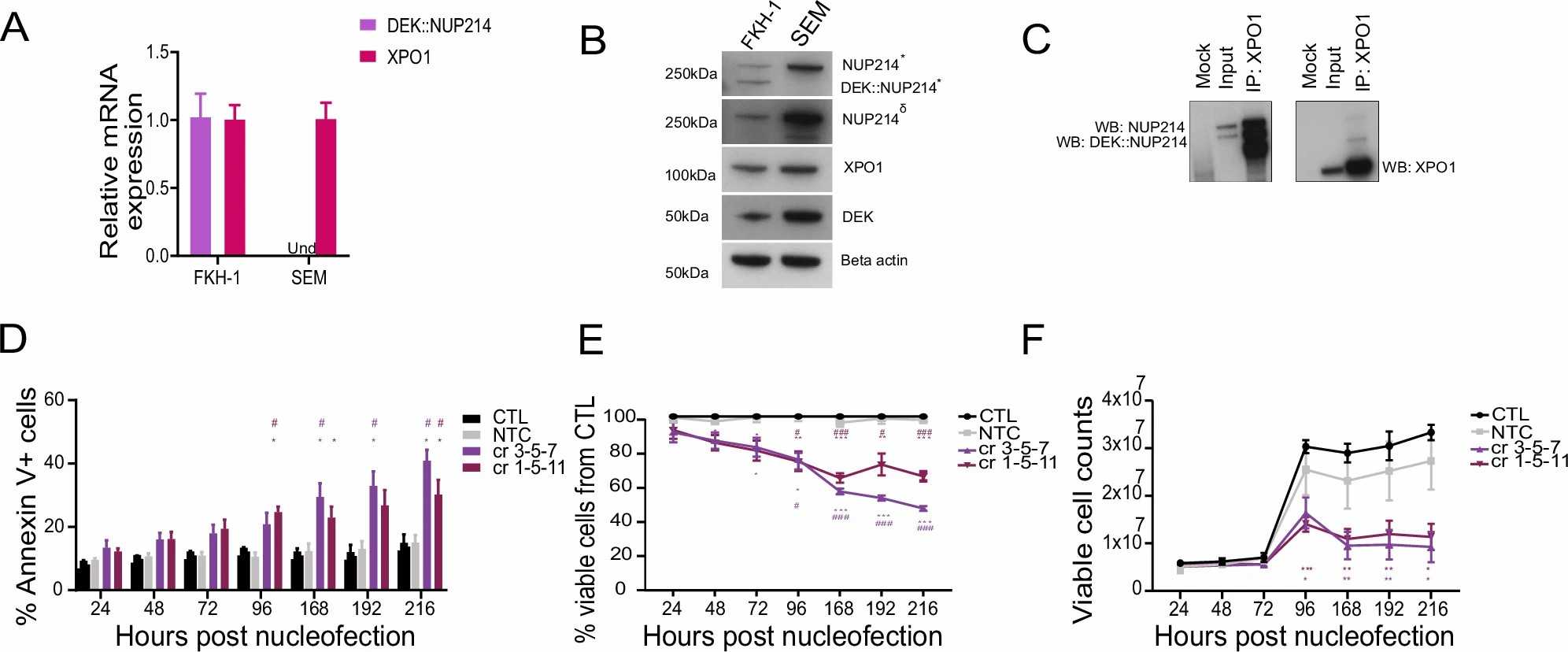 DEK::NUP214 leukemia is reliant on XPO1.