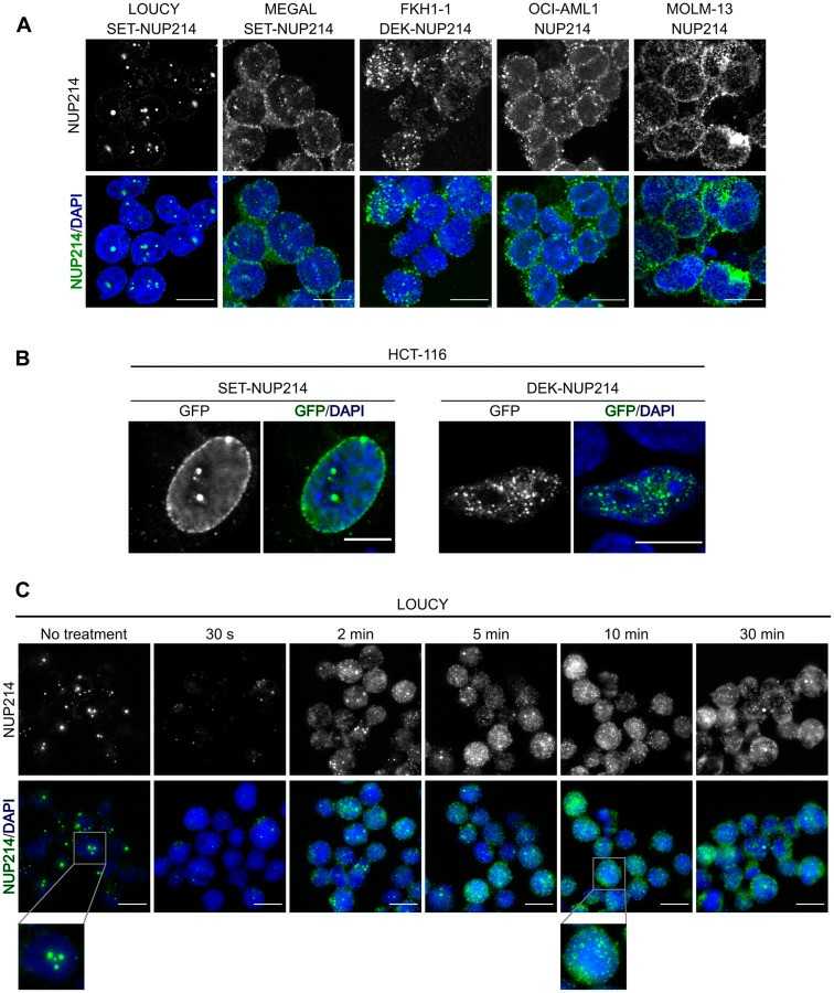 NUP214 fusion proteins are situated in specific nuclear bodies.