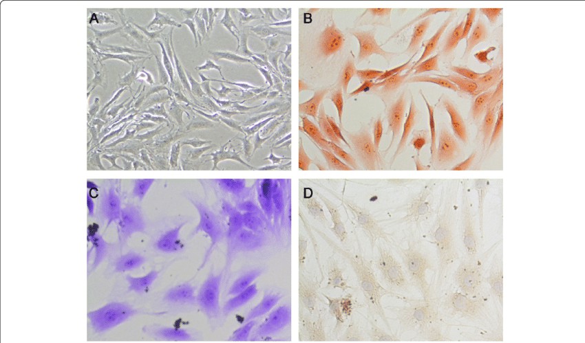 A. The gross morphology of the nucleus pulposus cells. B. Safranin O staining of NP cells. C. Toluidine blue staining of NP cells. D. Immunohistochemically for collagen II of NP cells.