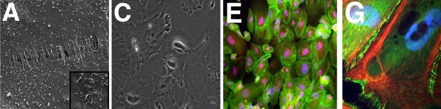 The morphology of immortalized human podocytes was observed using various techniques: scanning electron microscopy (A, 100), light microscopy (C), immunofluorescence staining for β-actin (green) and nestin (red) (E), and F-actin (red) and ZO-1 (green) with DAPI nuclear counterstaining (G).