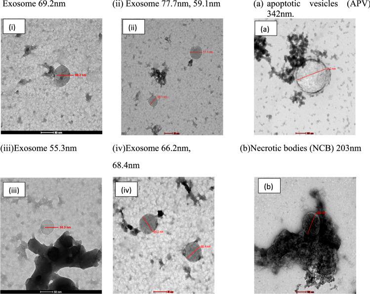 TEM was used for morphology characterization of the exosome.