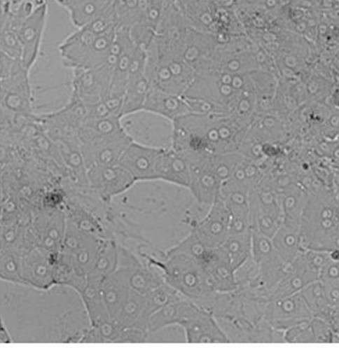 Freshly isolated primary pig hepatocytes were seeded on a collagen layer immediately after isolation.