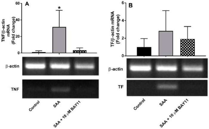 Gene expression levels in HCtAEC in response to SAA were compared with and without the presence of BAY11-7082 under normal glucose conditions.