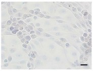 Immunohistochemical staining of IPEC-J2 cells with anti-Ki67 antibodies.