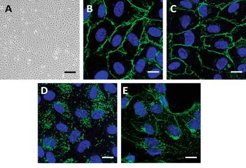 Characterization of primary endothelial cells involves (A) observing a confluent monolayer of HUVECs grown on gelatin-coated plastic, prepared for microscopy analysis. For the purpose of immunofluorescence microscopy, confluent HUVECs were stained using endothelial markers: (B) anti-PECAM-1 (CD31), (C) anti-VE-cadherin, (D) anti-von Willebrand factor (VWF), and (E) anti-VEGFR2 antibodies, all shown in green. Nuclei are stained with DAPI, shown in blue.