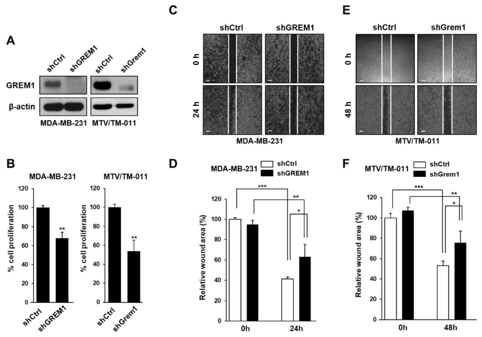 The growth and mobility of breast cancer cells were inhibited by GREM1 knockdown.