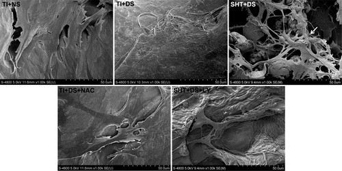 On day 7 of incubation, osteoblast morphology was observed in each group using SEM.
