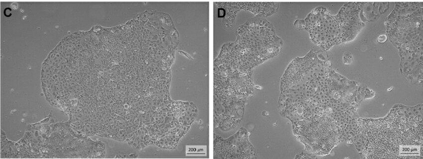 Phase-contrast images of CCD841 CoN cells at early vs. late passages.