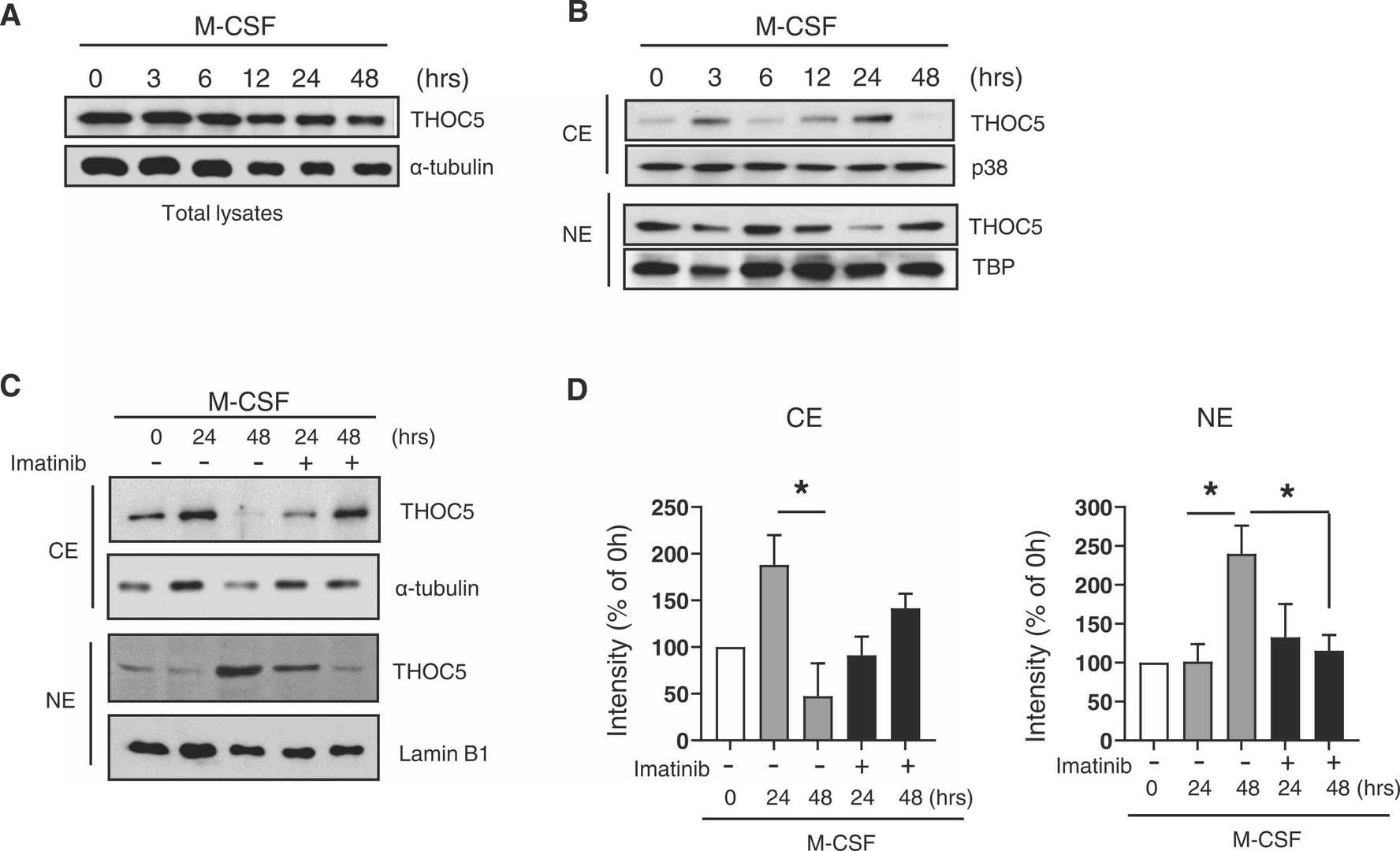 Osteoclastogenesis dynamically regulate subcellular localizations of THOC5.