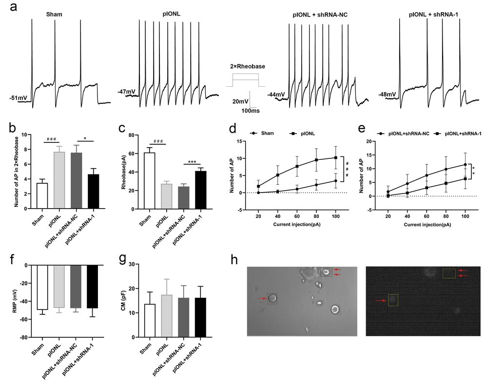 Reducing Anxa10 expression decreased hyperexcitability in trigeminal ganglion (TG) neurons of mice post-pIONL.