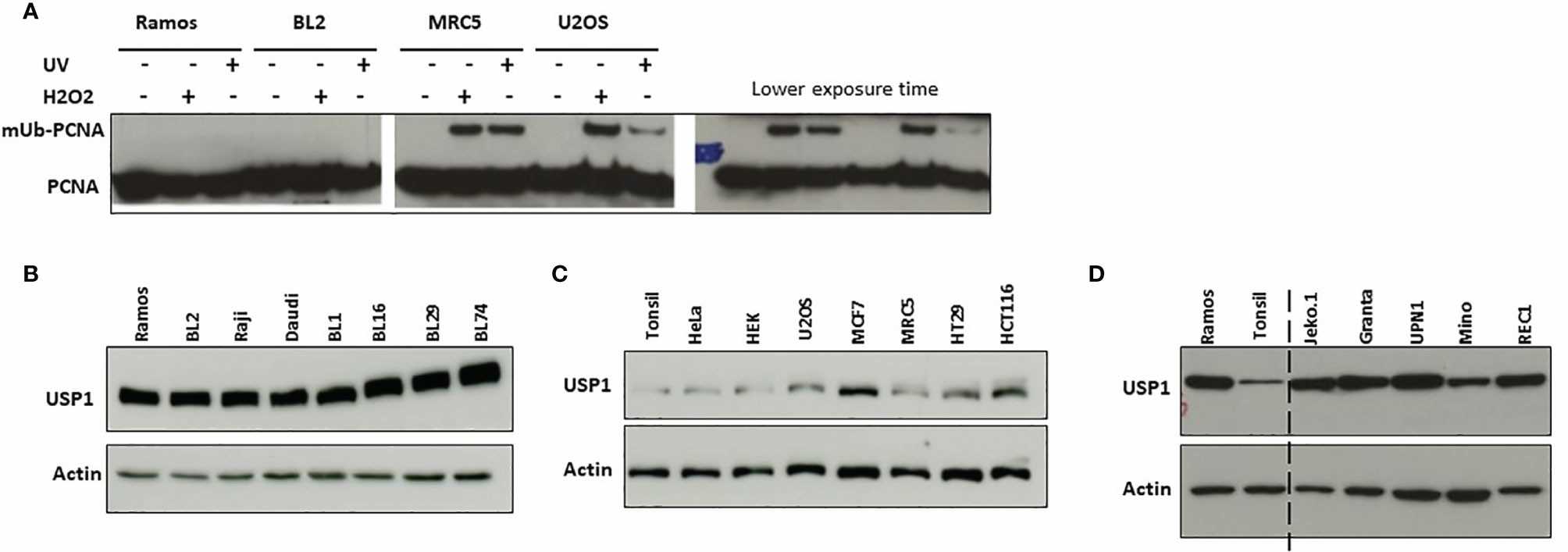Induction of PCNA monoubiquitination USP1 expression in Ramos and BL2 cells.