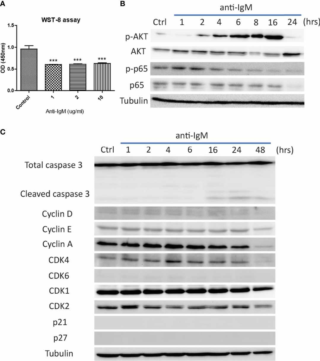 The detrimental effects of anti-IgM on Ramos B cells 