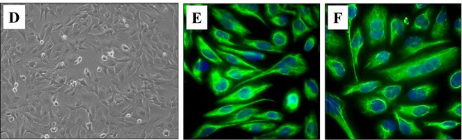 (D) Phase contrast microscopy image of proliferating HMC3 cells (20X magnification). Immunofluorescence image of resting (E) and activated immortalized human microglia HMC3 cells (F) stained for vimentin cytoskeletal filaments with XNAMEX primary antibody and secondary mouse IgG antibody conjugated to CruzFluor488 (green fluorescence), nuclei stained with DAPI (blue fluorescence).