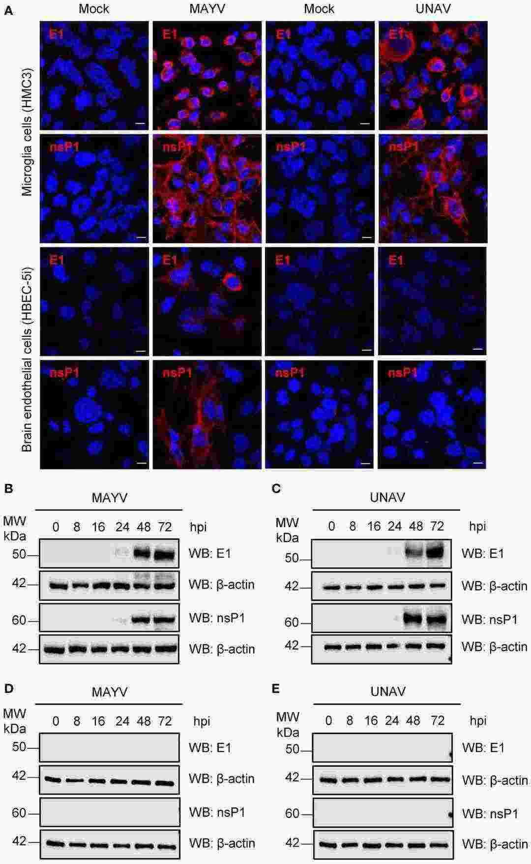 Detection of viral E1 and nsP1 proteins in MAYV- or UNAV-infected HMC3 and HBEC-5i cells.